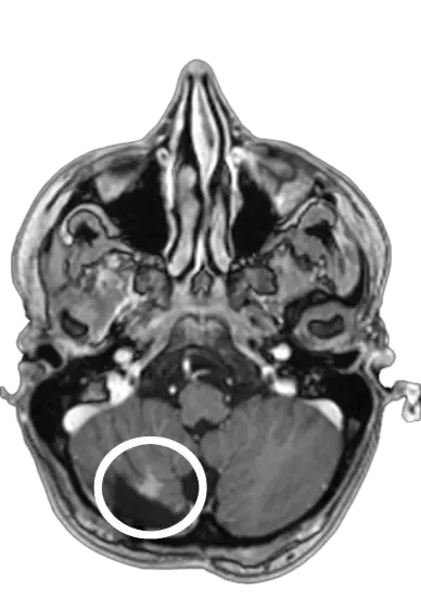 Picture of a scan of a skull.